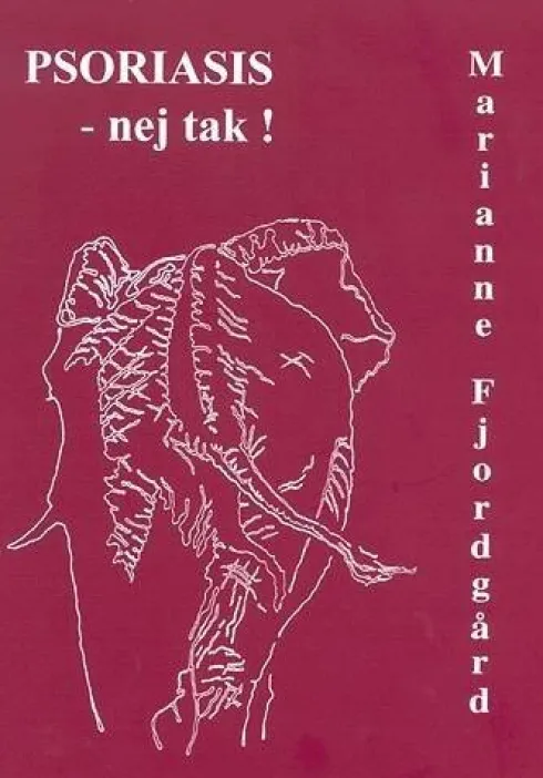 Psoriasis - Nej Tak!