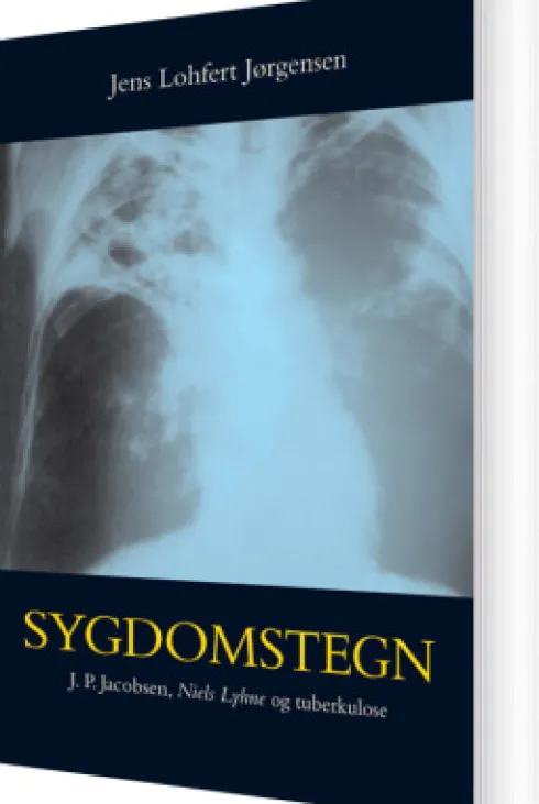Sygdomstegn